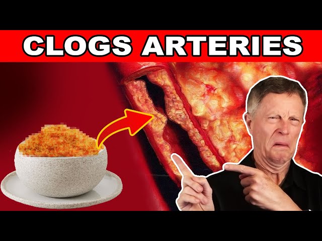 #1 Worst Meal that Is Clogging your Arteries