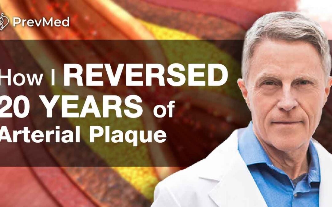 How to Reverse 20 Years of Arterial Plaque