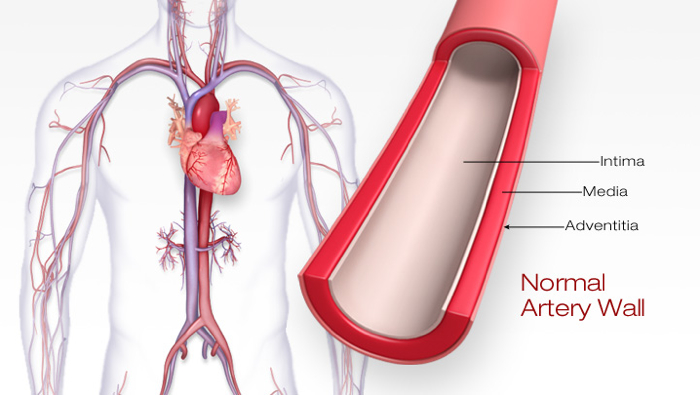 Layers of the Artery - Intima, Media, Adventitia