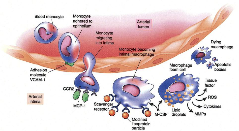 Monocyte, Macrophage, and Lp-PLA2 mechanism