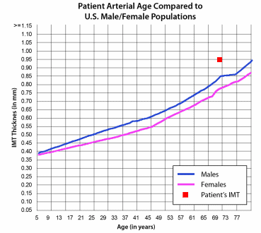 Sample Nomogram (CardioRisk Report)