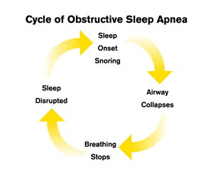 The Cycle of Obstructive Sleep Apnea - OSA