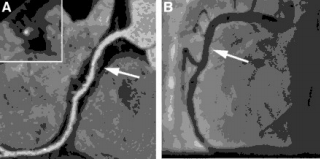 Sample CT Angiogram Images