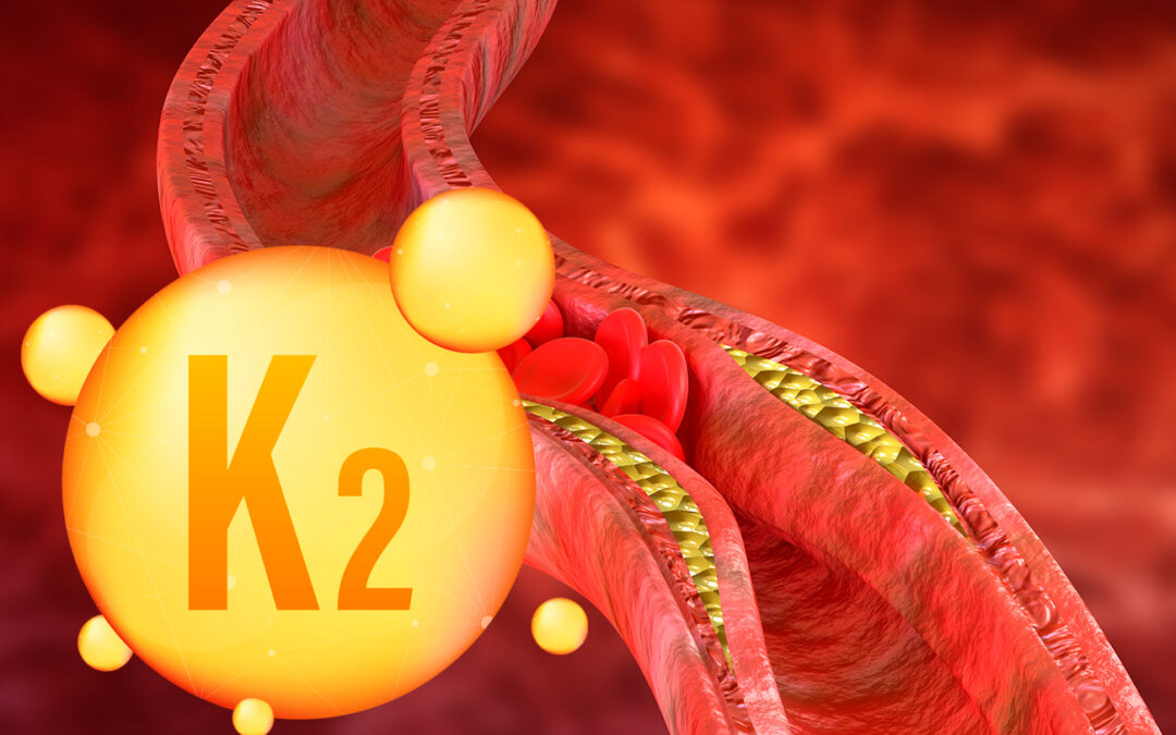 Vitamin K2 and Artery Calcification Series Part 2