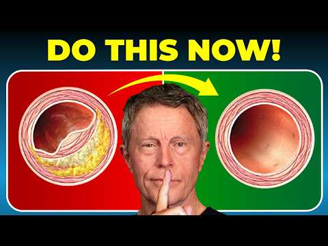 Don’t Wait: Do THIS NOW to Clean your Arteries